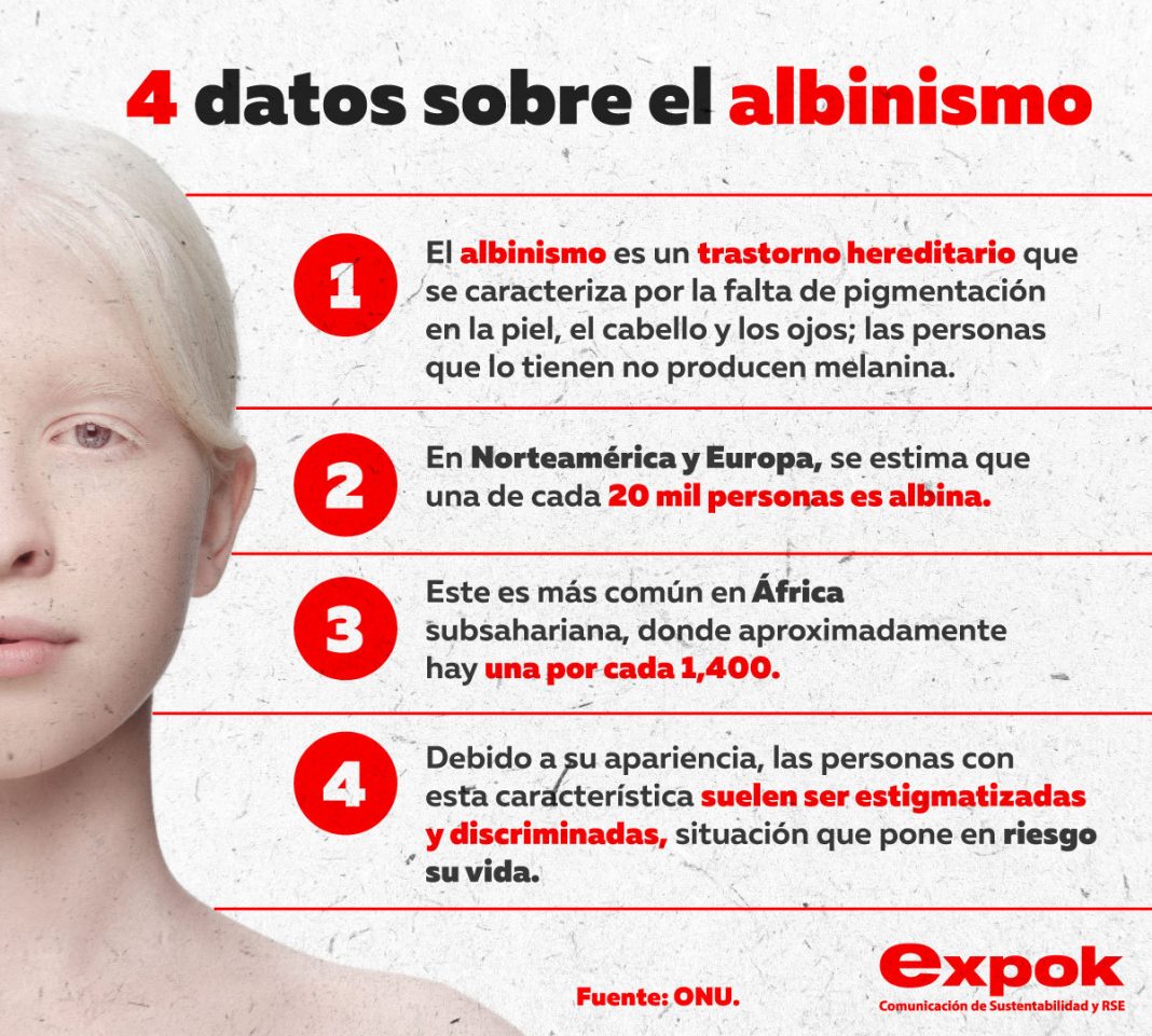 Infografia-expok-albinismo el albinismo expok