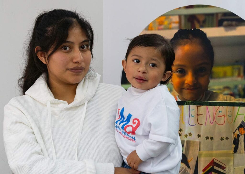 cirugías de labio y paladar hendido