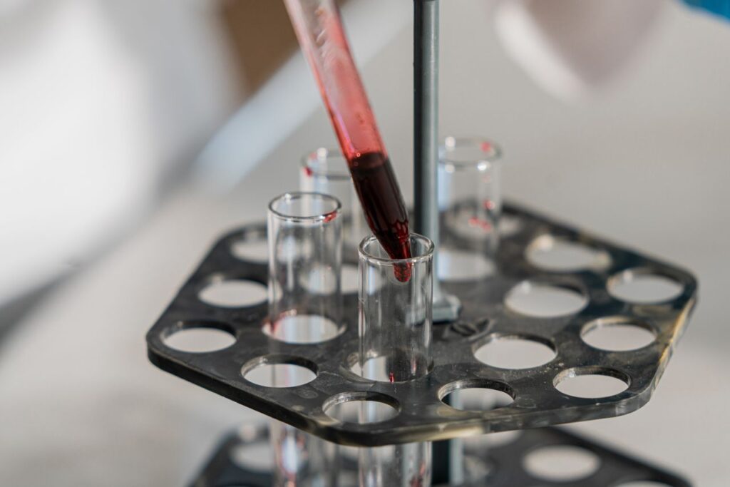 composición química de la sangre